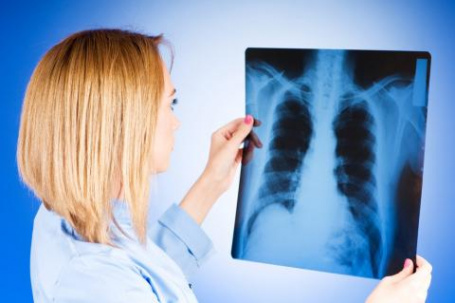 В Дружковке выявлен первый за год случай туберкулеза
