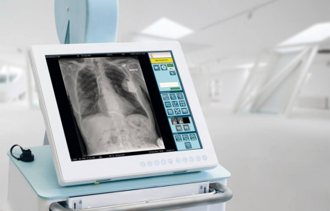 В ЦГБ закупят переносной рентгеновский аппарат