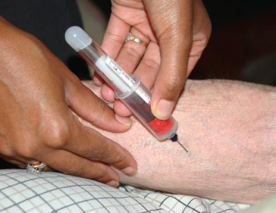За неделю в Дружковке зафиксировано три случая гепатита