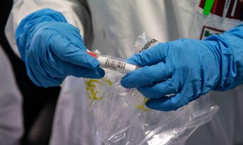 В Украине подтвердились еще два случая коронавируса