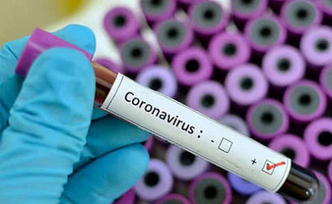 За тиждень у Дружківців п'ять випадків COVID-19 За тиждень у Дружківців п'ять випадків COVID-19