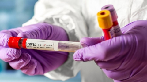 В Дружковке за сутки не зафиксировано новых случаев заражения коронавируса