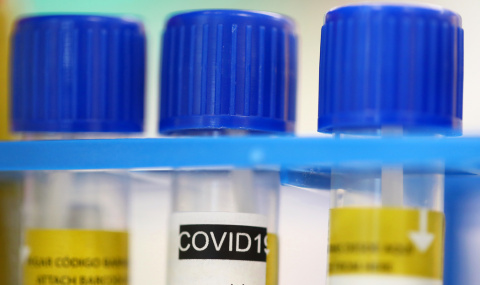 Стали известны результаты анализа жителя Дружковки с подозрением на коронавирус
