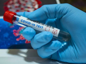 В Украине за сутки 476 новых случая заражения коронавирусом