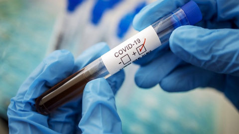 В Дружковке за сутки два новых случая коронавируса