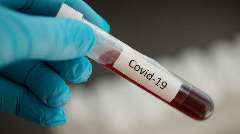В Дружковке 12 новых случаев коронавируса