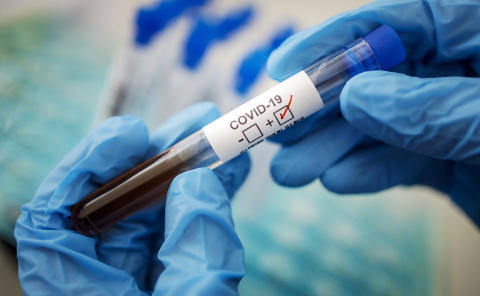 В Дружковке 62 человека ожидают результатов тестирования на коронавирус