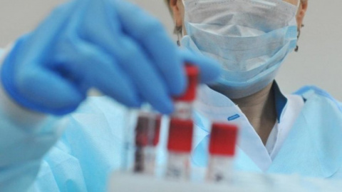 В Украине за сутки зафиксировано 972 новых случаев заражения коронавирусом, в Донецкой области – 12