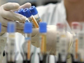 В Украине за сутки выявлено 483 новых случая заражения коронавирусом