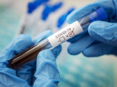 В Дружковке за сутки выявлено пять новых случаев коронавируса, в том числе у троих медиков