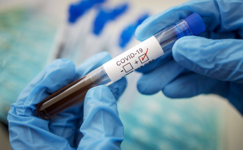 В Дружковке за сутки выявлено пять новых случаев коронавируса, в том числе у троих медиков