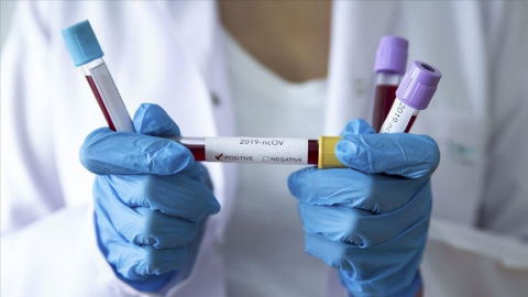 В Дружковке девять новых случаев заражения коронавирусом, в том числе у двоих медиков