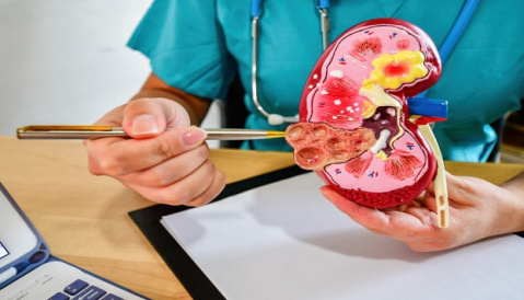 Як перемогти пієлонефрит: поради для відновлення здоров’я нирок