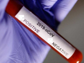 В Дружковке тестирование на коронавирус прошли 3% населения