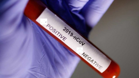В Дружковке тестирование на коронавирус прошли 3% населения