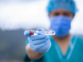 Почти тысяча новых случаев коронавируса зафиксирована в Украине за сутки