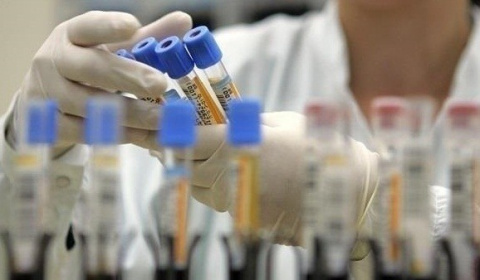 В Украине за сутки зафиксировано 340 новых случаев заражения коронавирусом