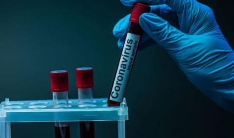 В Дружковке коронавирус обнаружили у 20-летней медработницы
