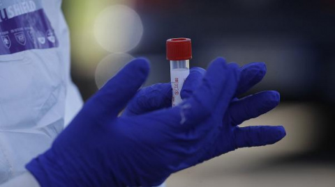 В Дружковке 17 человек ожидают результатов теста на коронавирус