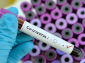 В Украине зафиксировано 84 случая заражения коронавирусом