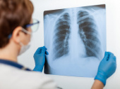 Очередь в рентген-кабинет: как в Дружковке справляются с наплывом пациентов