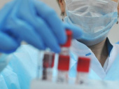 В Украине зафиксировано 143 новых случая заражения коронавирусом