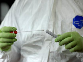 В Украине зафиксировано 113 случаев заражения коронавирусом