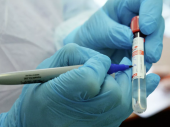В Украине установлен очередной антирекорд по количеству заболевших коронавирусом
